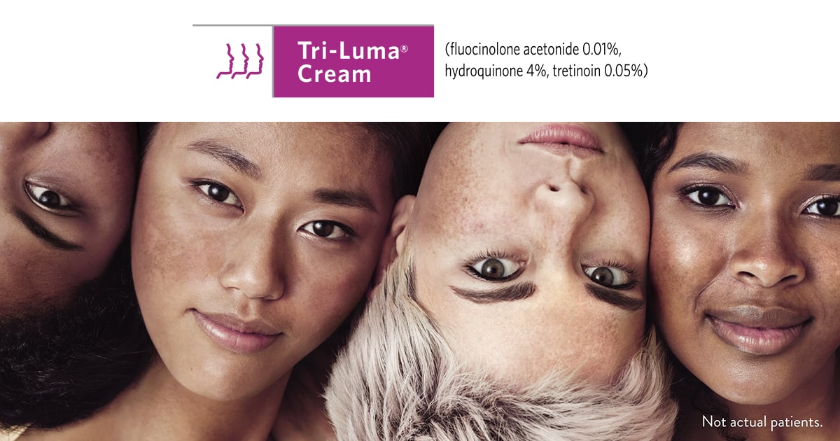 Prescription Melasma Treatment TriLuma® Cream